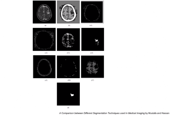 Brain images while brain is clustering info